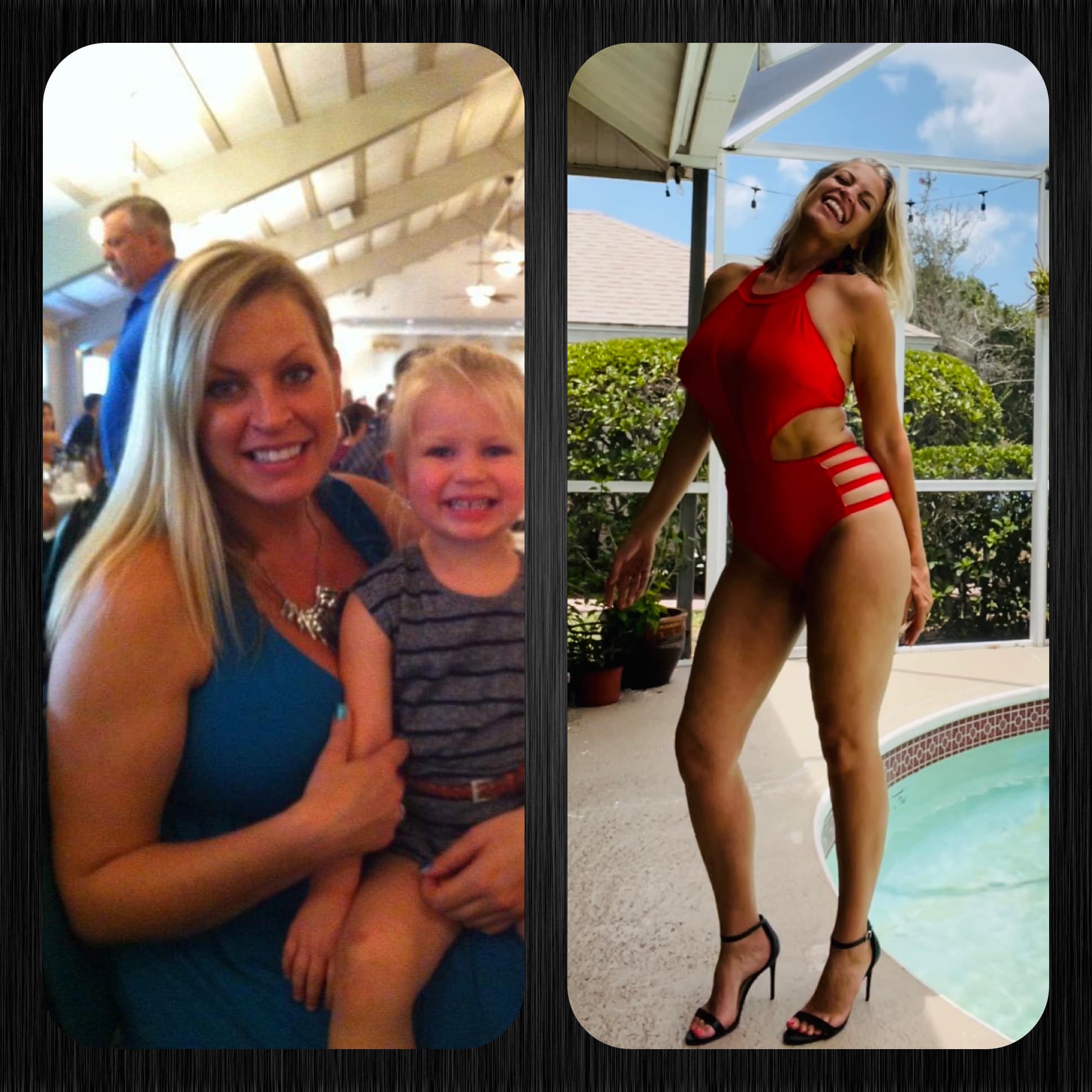 Mandy Before and After Body Freedom